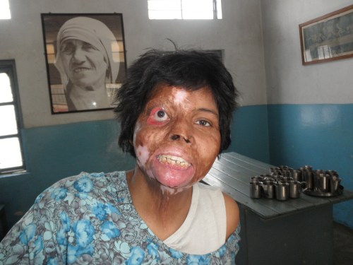 Distressing Disguise